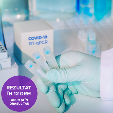 Test Real Time PCR Covid-19 cu rezultat în 12h